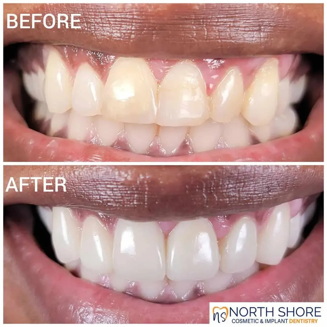 Expert Cosmetic Dentistry Services in Great Neck